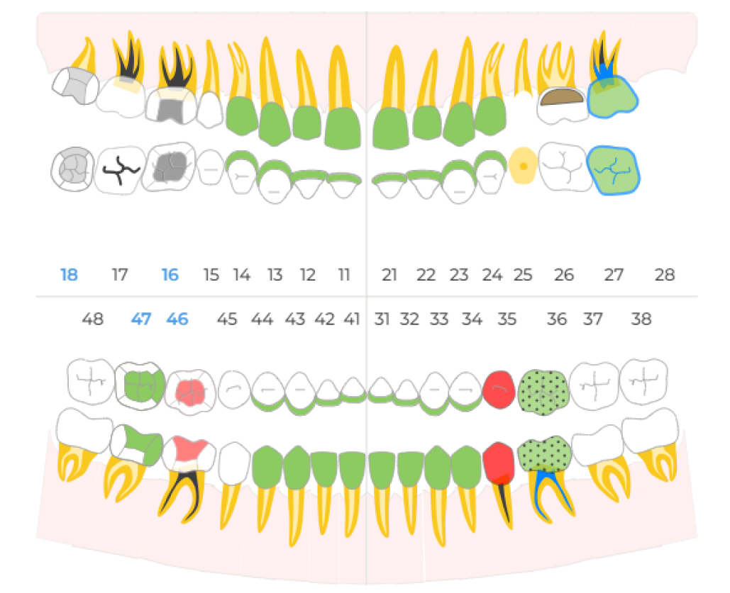 dental-formula-1.jpg