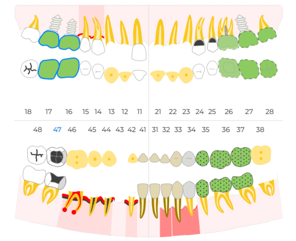 dental-formula-2.jpg