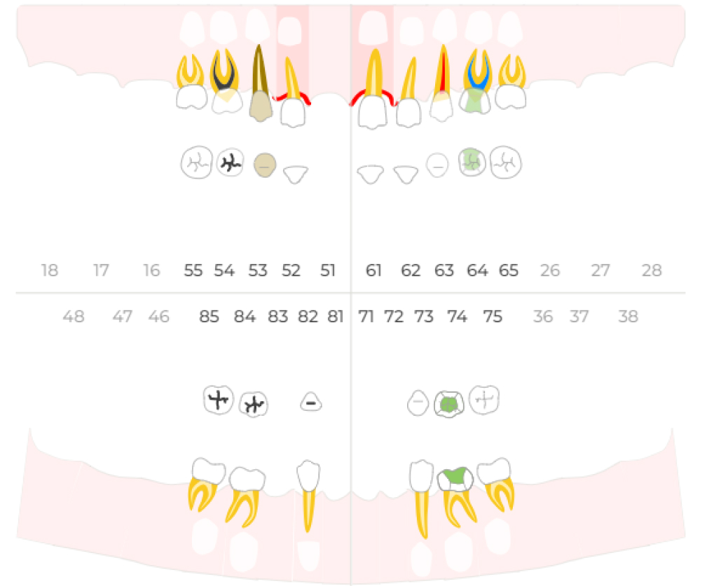 dental-formula-3.jpg