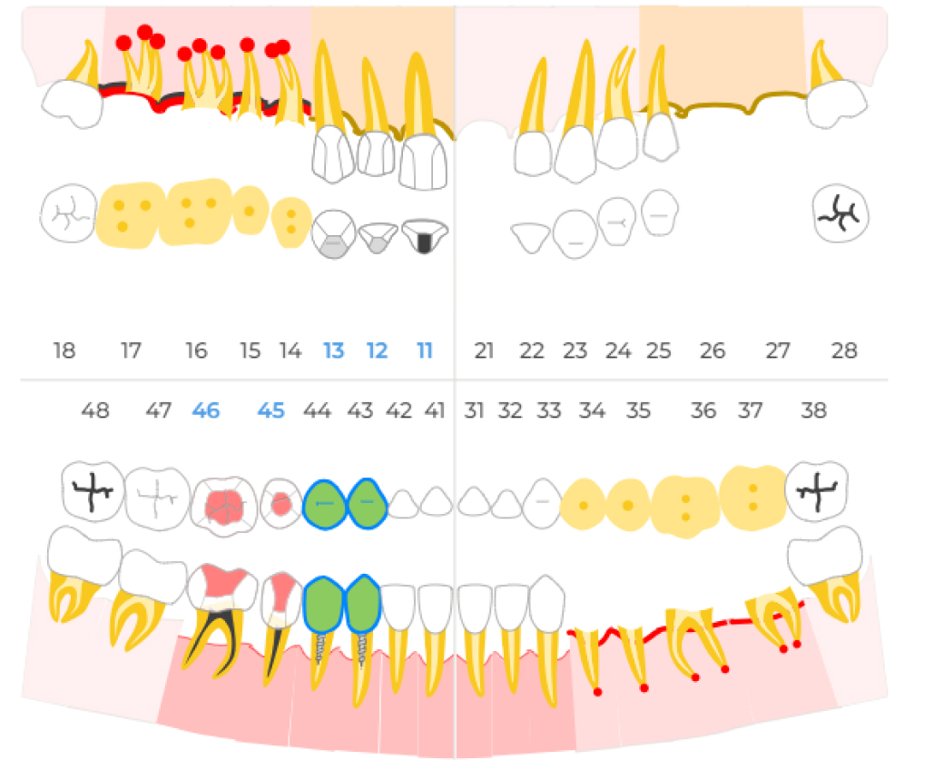 dental-formula-4.jpg